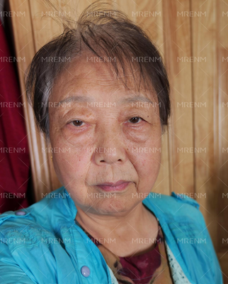 美人媄 80歲老太擁有少女容顏的秘密武器